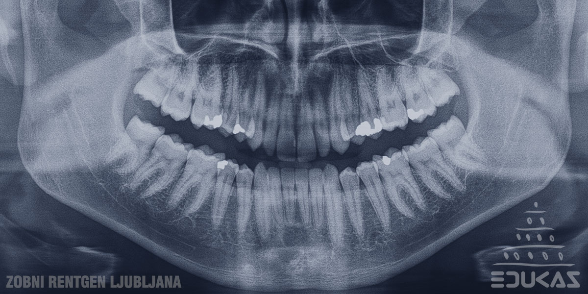 Ortopan posnetek RTG zob